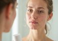 HydraFacial Breakouts: Purging or Problem?